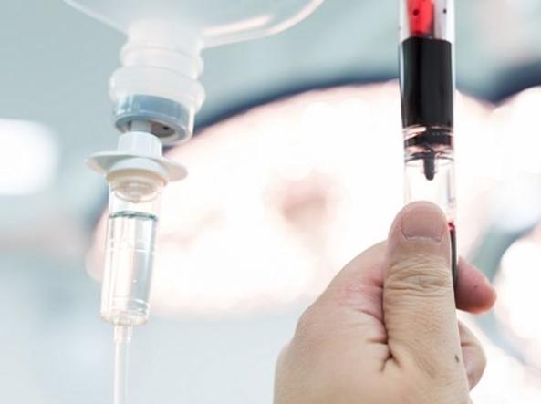 Il trapianto di midollo compie sessant’anni: tutte le tappe