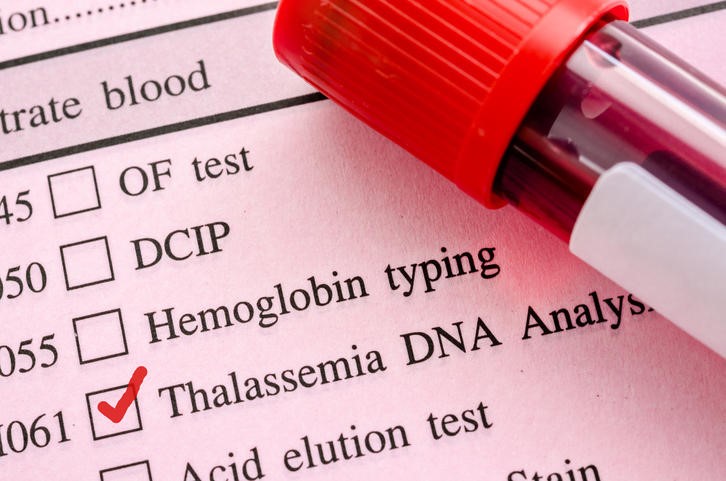 Beta-talassemia trasfusione-dipendente, luspatercet centra i bersagli in fase III