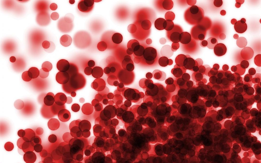 EPO (Erythropoietin) & other Erythropoiesis Stimulating Agents (ESAs) in the Treatment of MDS